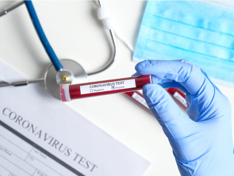 Nahaufnahme einer Hand, die eine Blutprobe für einen Coronavirus-Test hält
