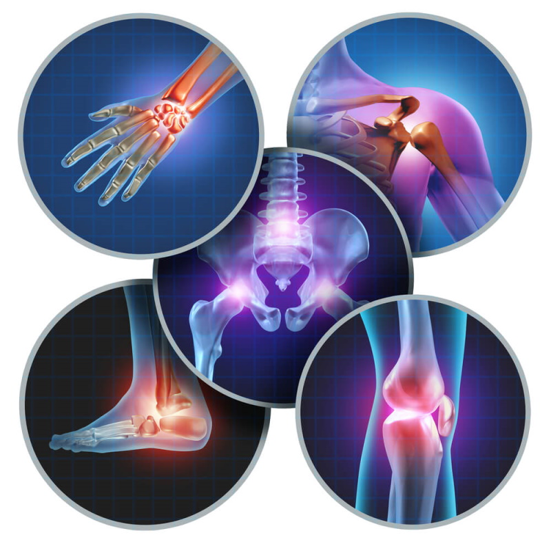 Arthritis kann in vielen Gelenken auftreten